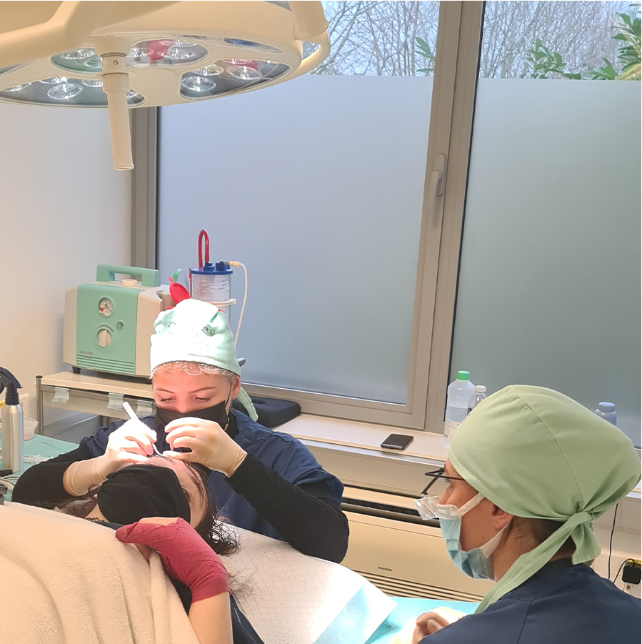 Hair technicians opening up the canals to implants te grfts following the FUE method.