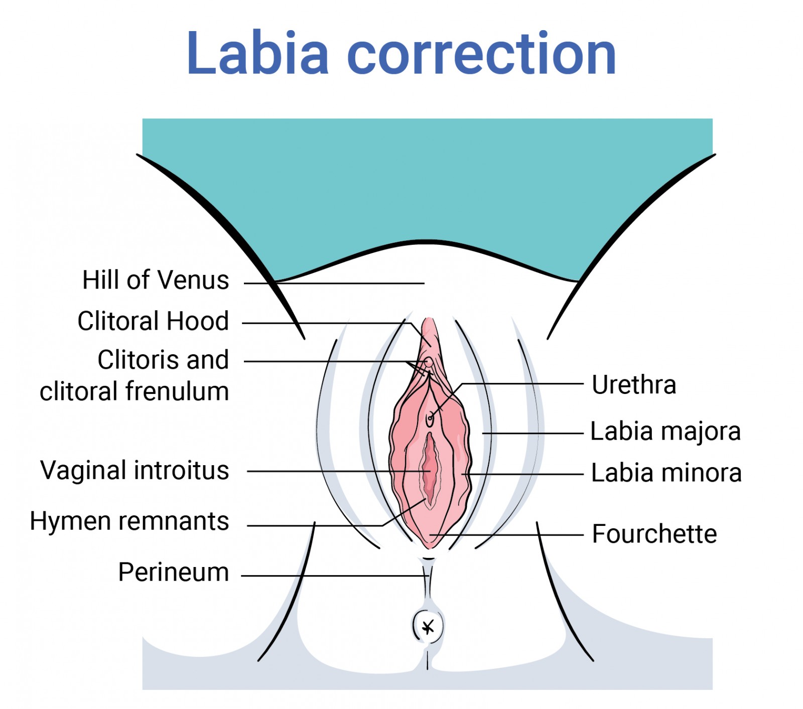 Body surgery labia correction before and after surgery in antwerp